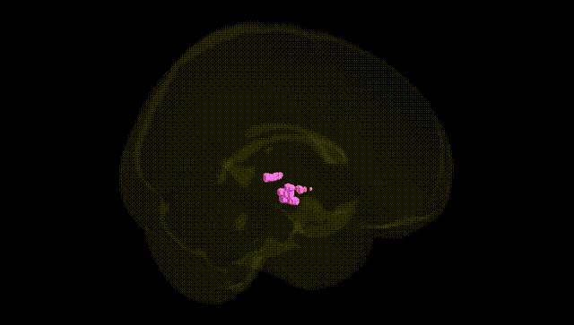 Full Brain Black