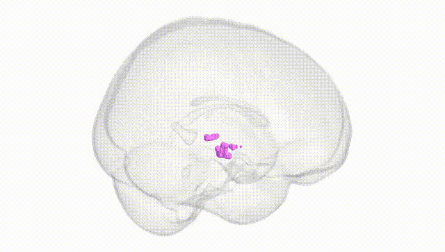 Full Brain White