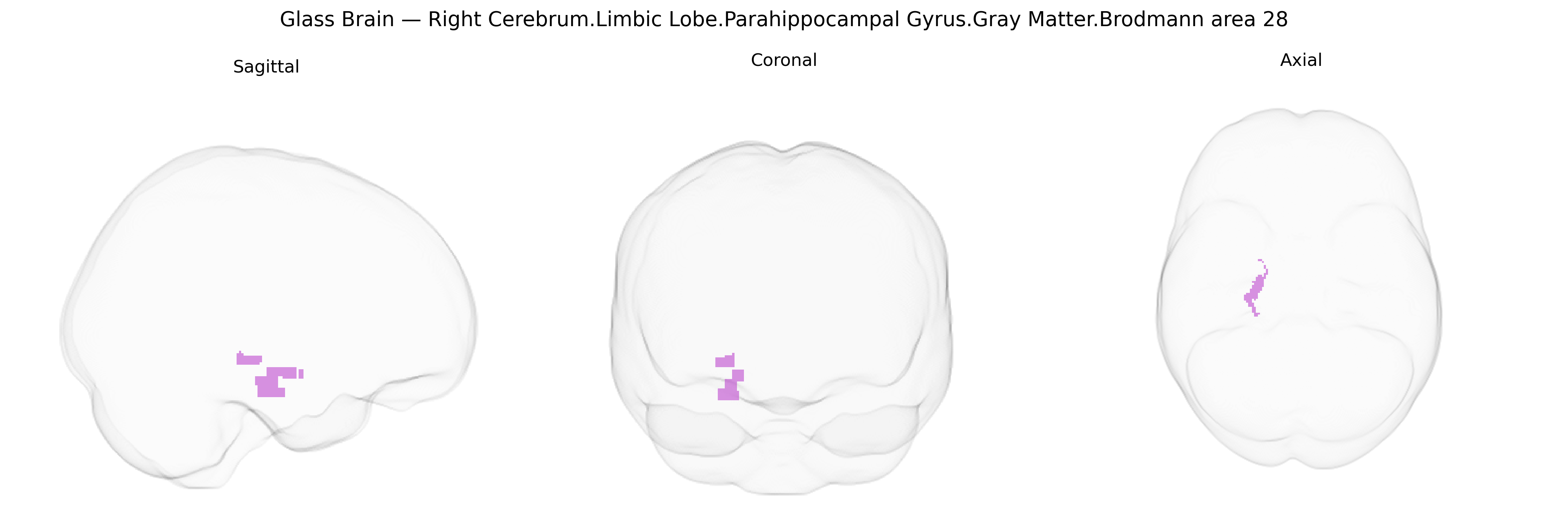 Triplanar Ghost Brain