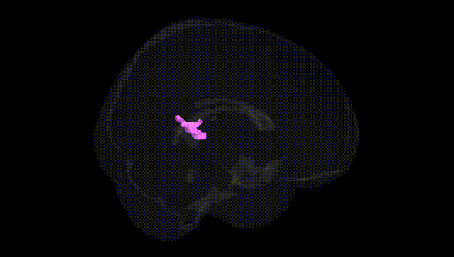 Full Brain Black