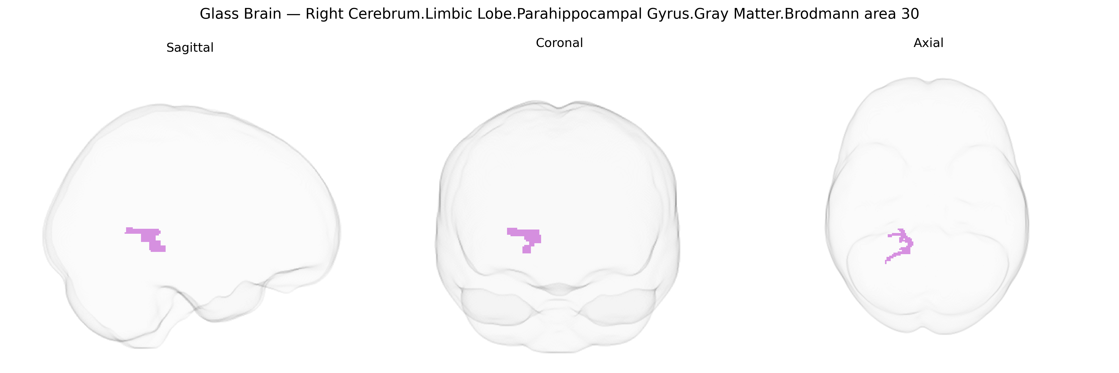 Triplanar Ghost Brain