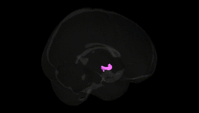 Full Brain Black