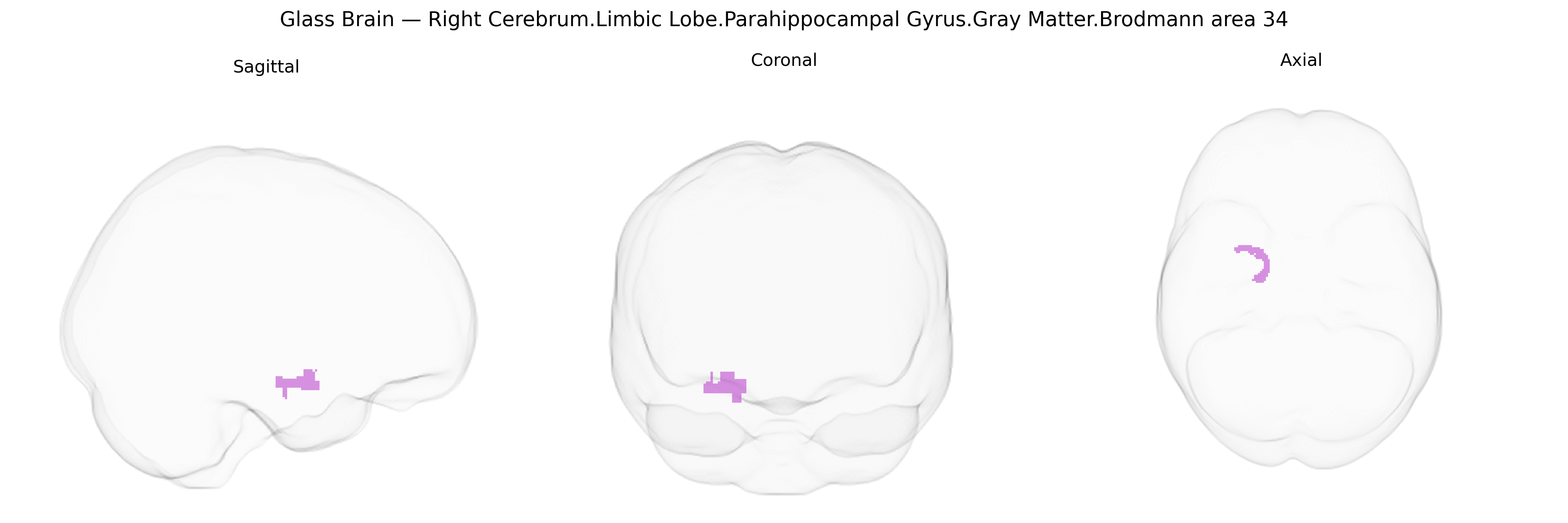 Triplanar Ghost Brain