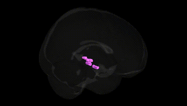 Full Brain Black