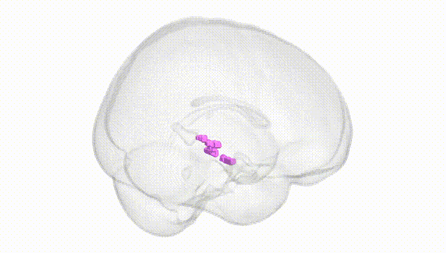 Full Brain White