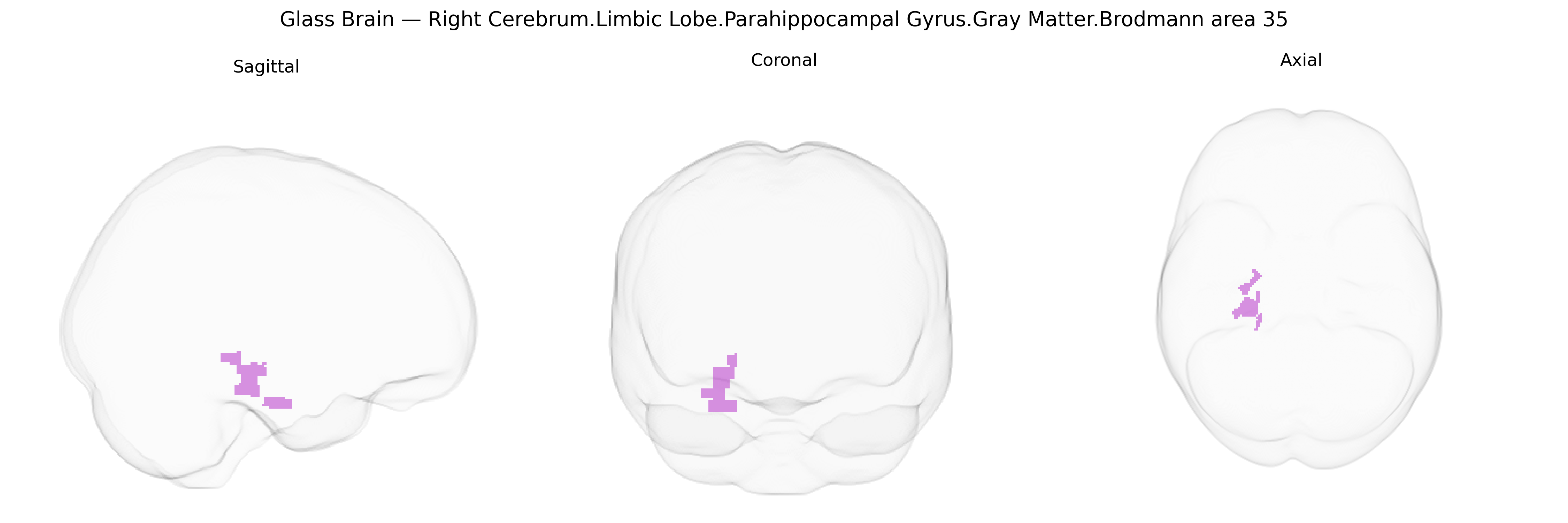 Triplanar Ghost Brain