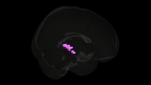 Full Brain Black