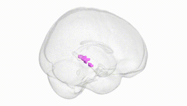 Full Brain White