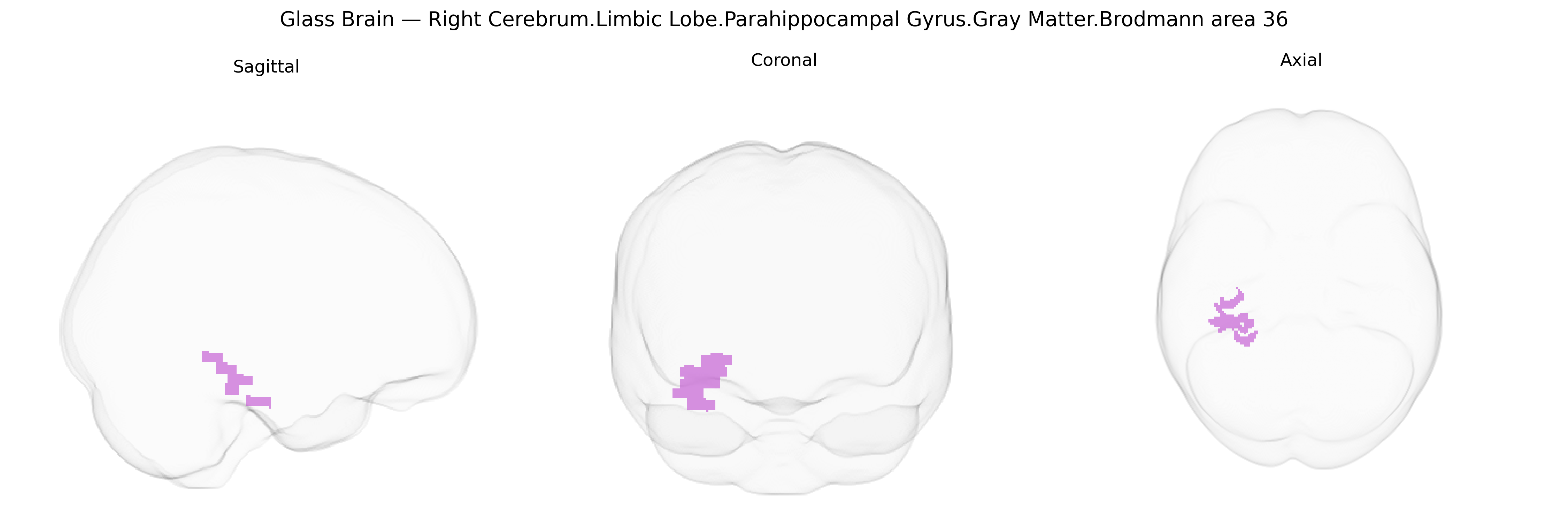 Triplanar Ghost Brain