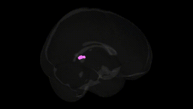 Full Brain Black