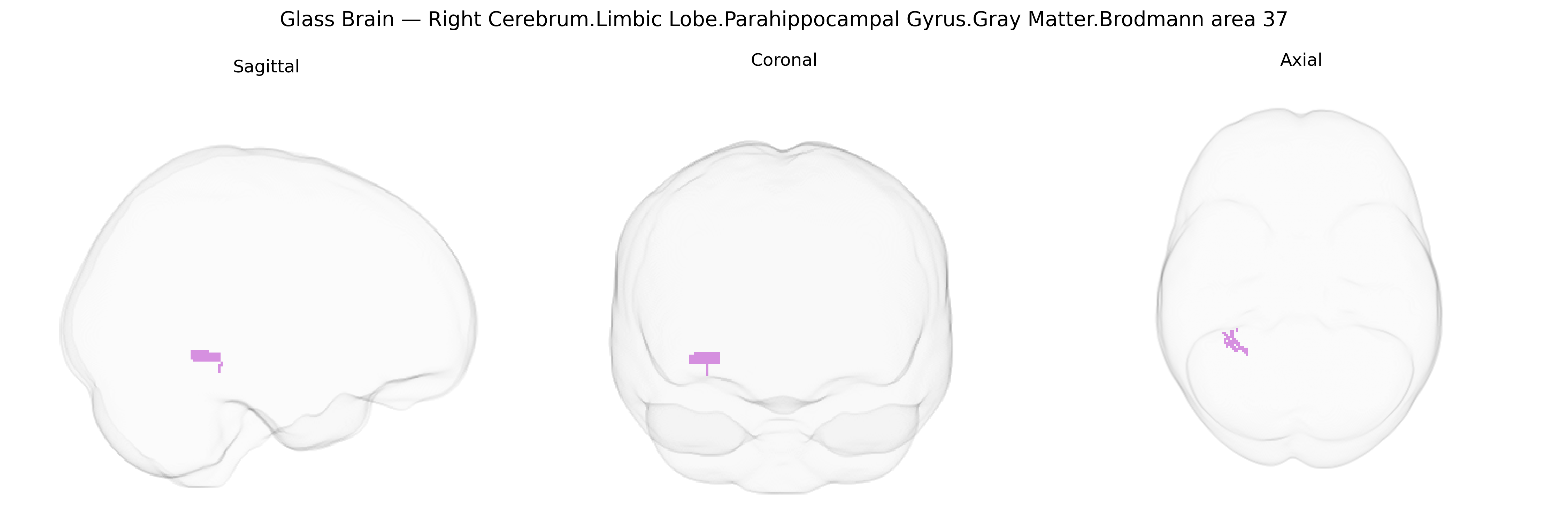 Triplanar Ghost Brain