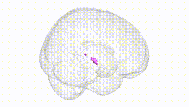 Full Brain White