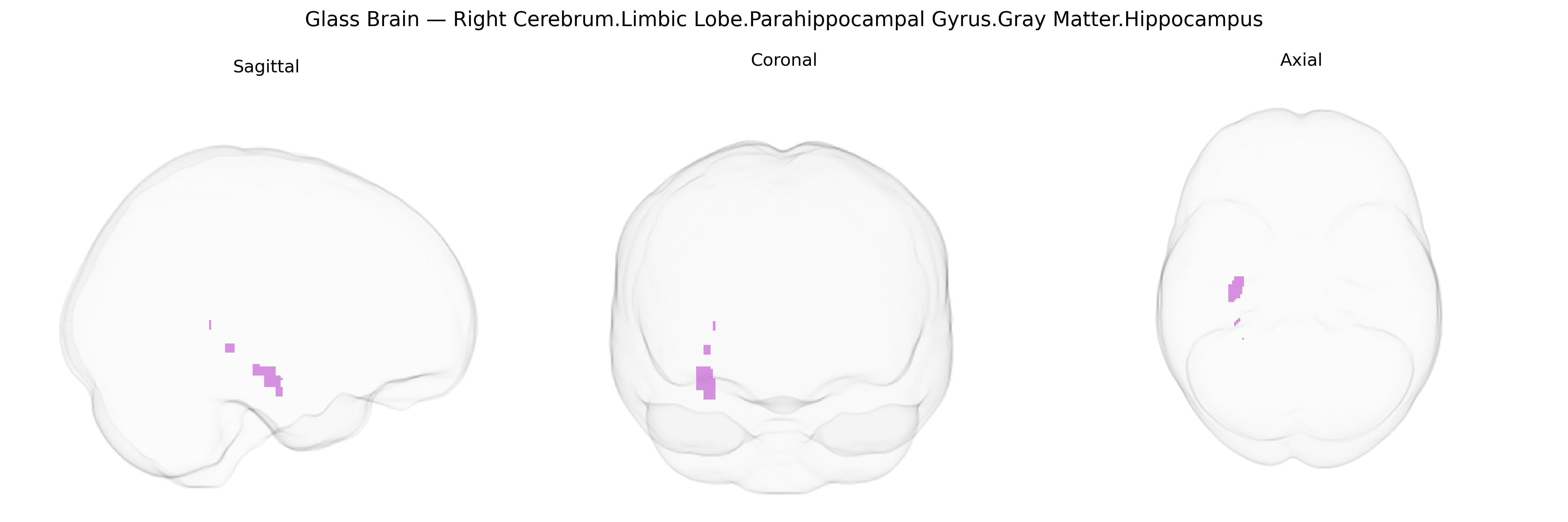 Triplanar Ghost Brain