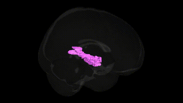 Full Brain Black