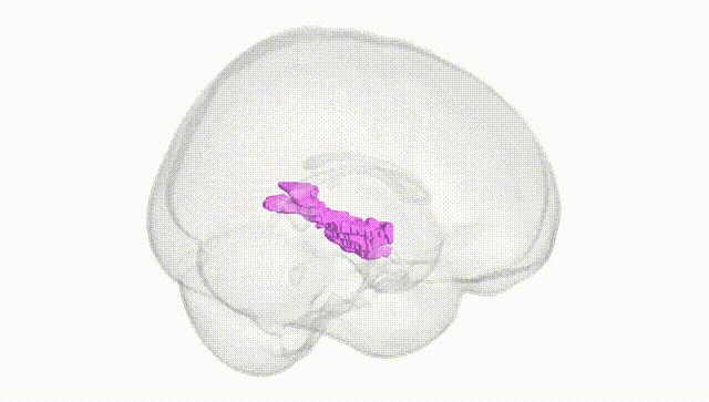 Full Brain White