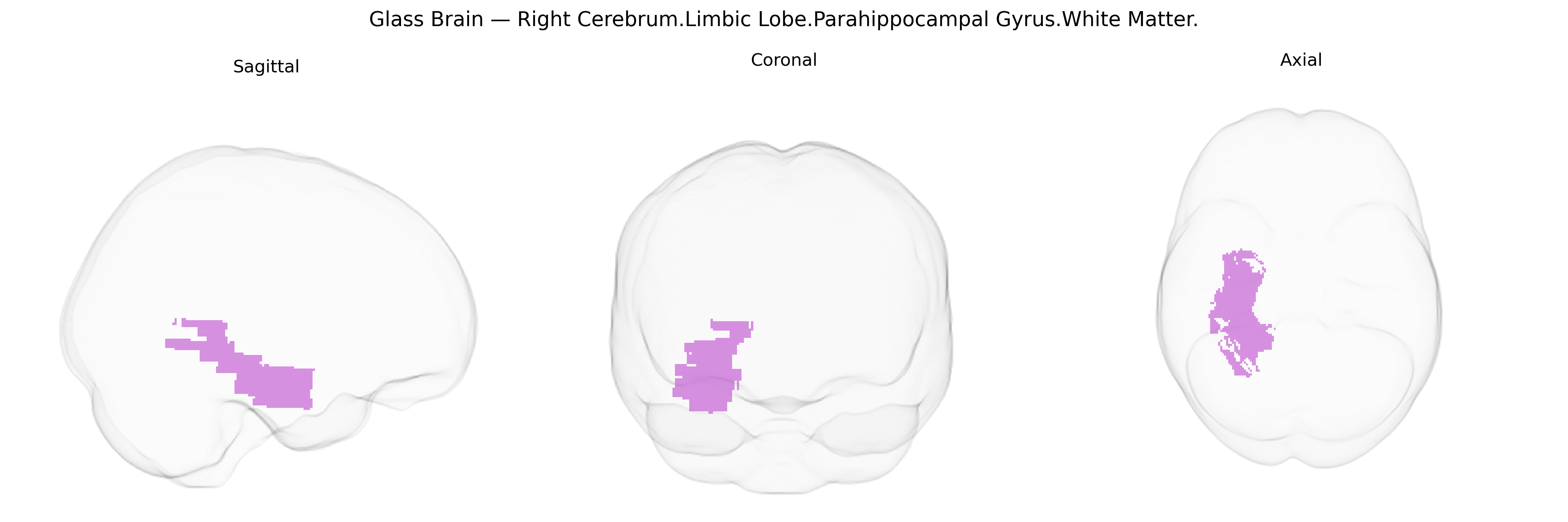 Triplanar Ghost Brain
