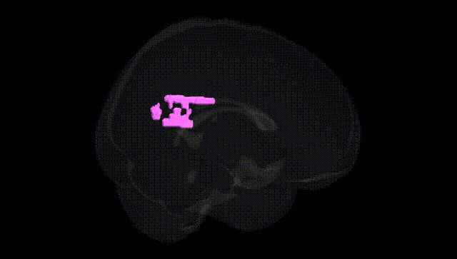 Full Brain Black