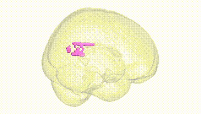 Full Brain White
