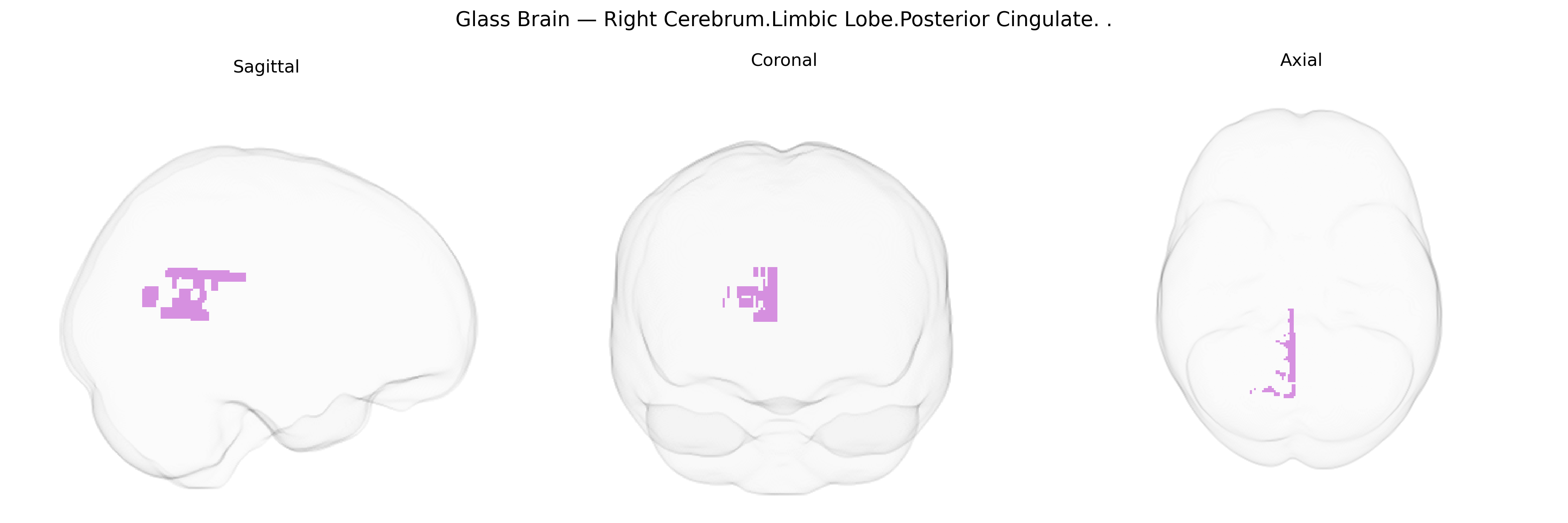 Triplanar Ghost Brain