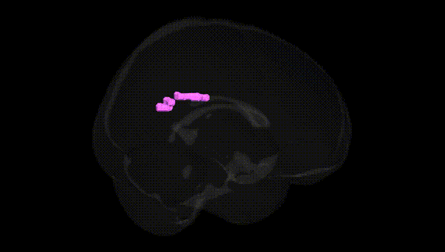 Full Brain Black