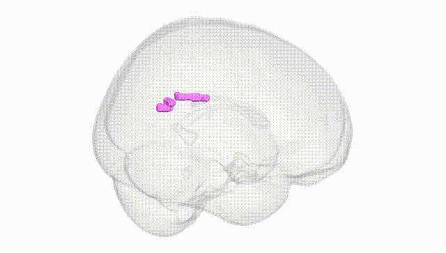 Full Brain White