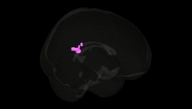 Full Brain Black