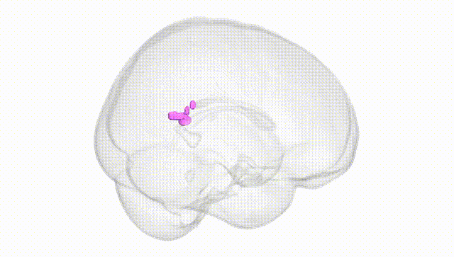 Full Brain White