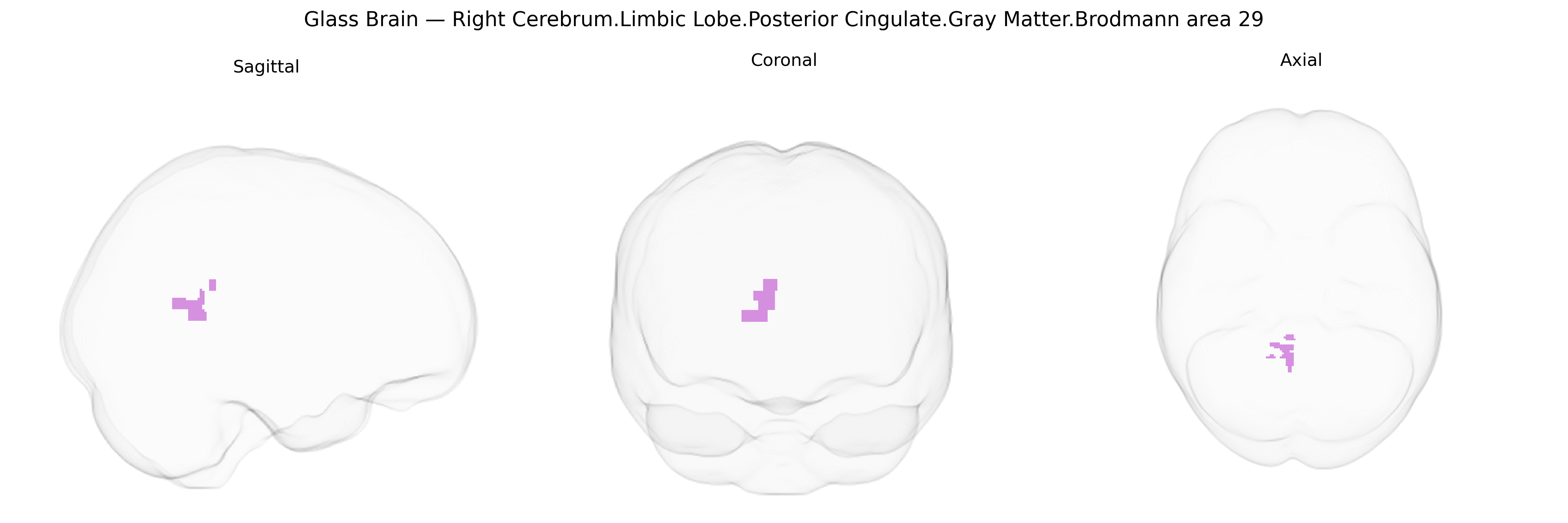 Triplanar Ghost Brain