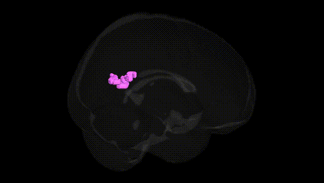 Full Brain Black