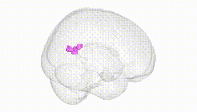 Full Brain White
