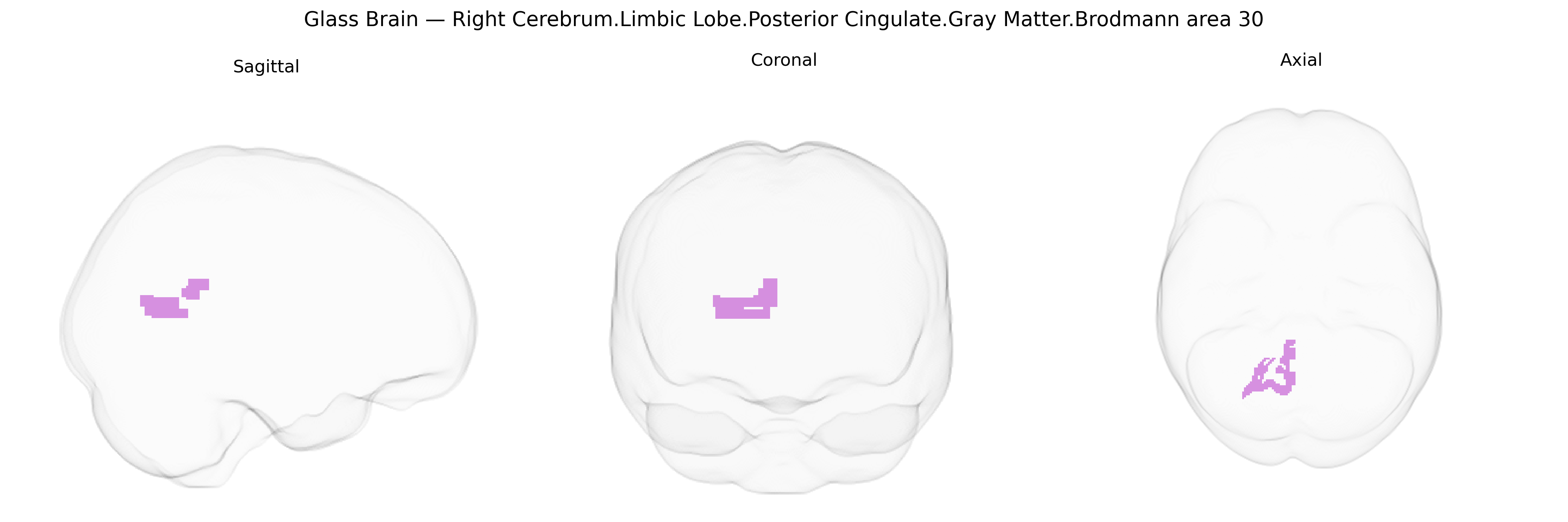 Triplanar Ghost Brain