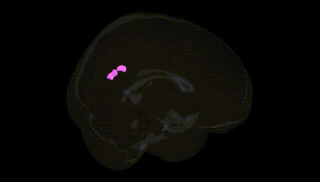 Full Brain Black