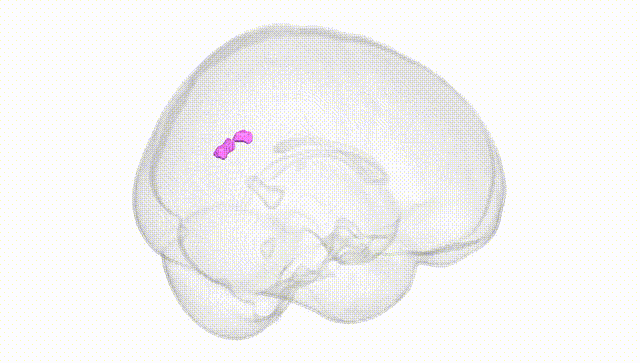 Full Brain White