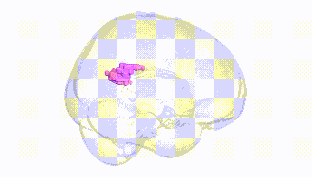 Full Brain White
