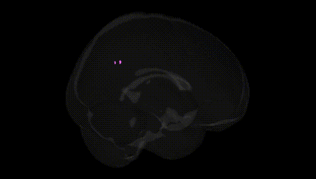 Full Brain Black
