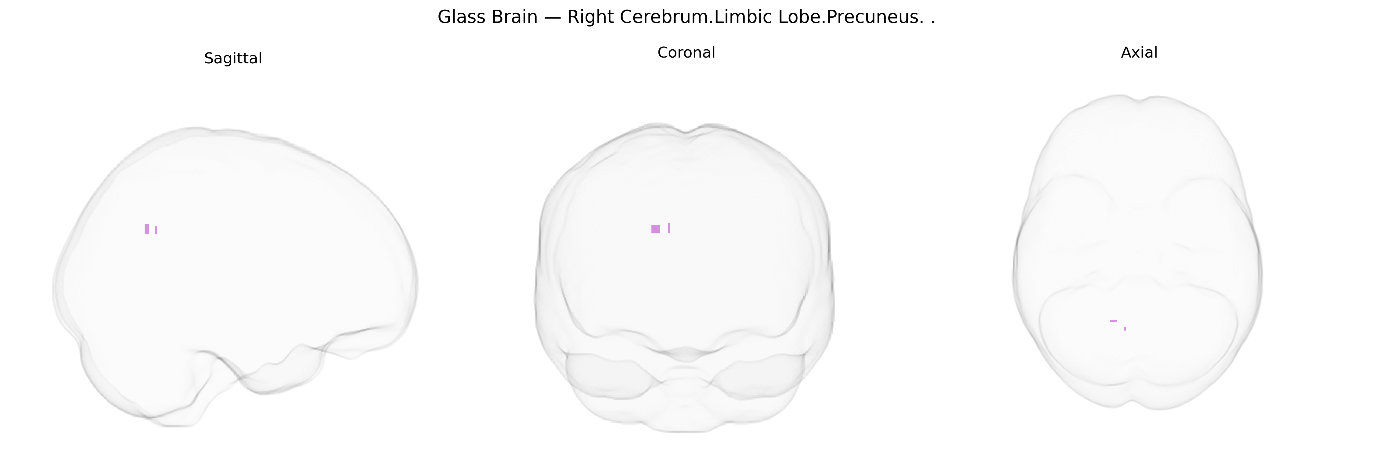 Triplanar Ghost Brain