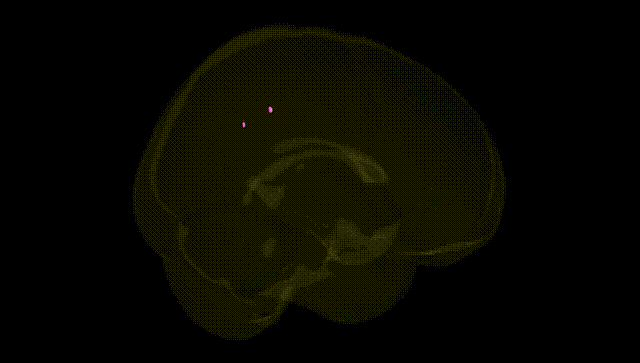 Full Brain Black