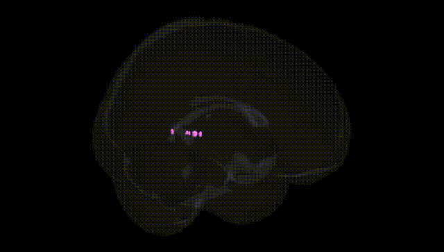 Full Brain Black
