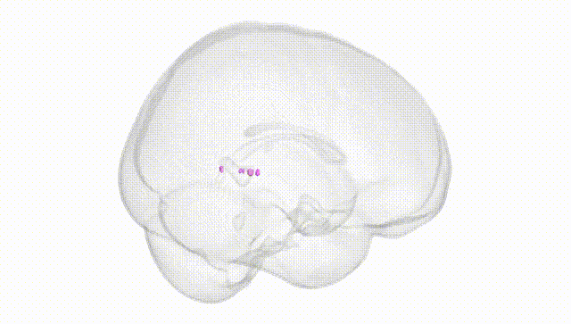 Full Brain White