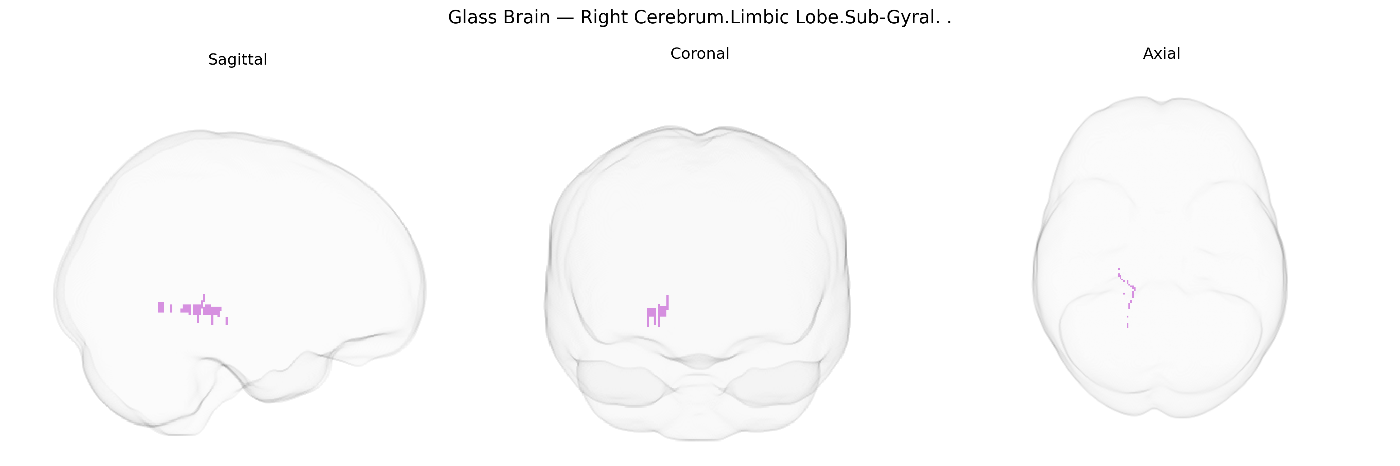 Triplanar Ghost Brain