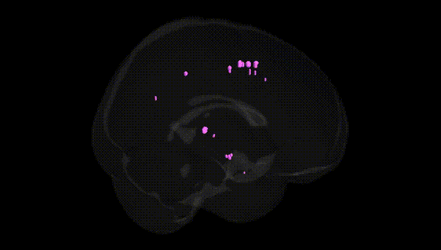 Full Brain Black