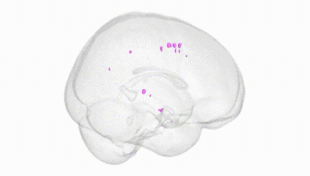 Full Brain White