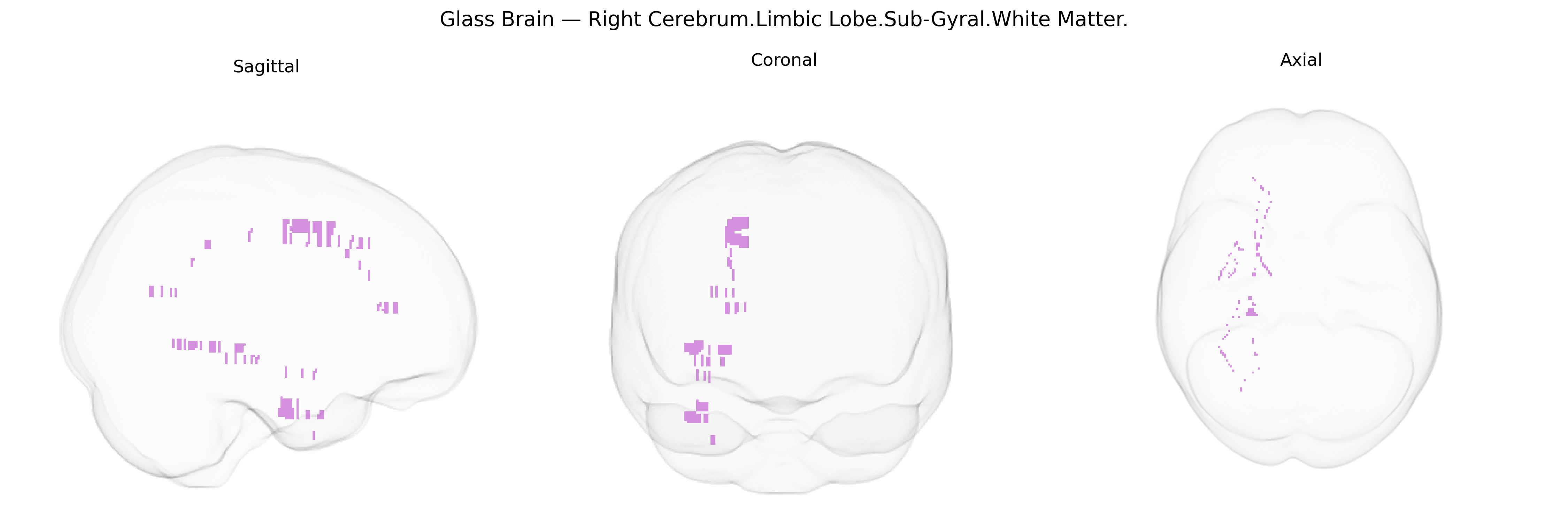 Triplanar Ghost Brain
