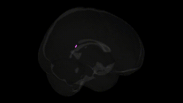 Full Brain Black