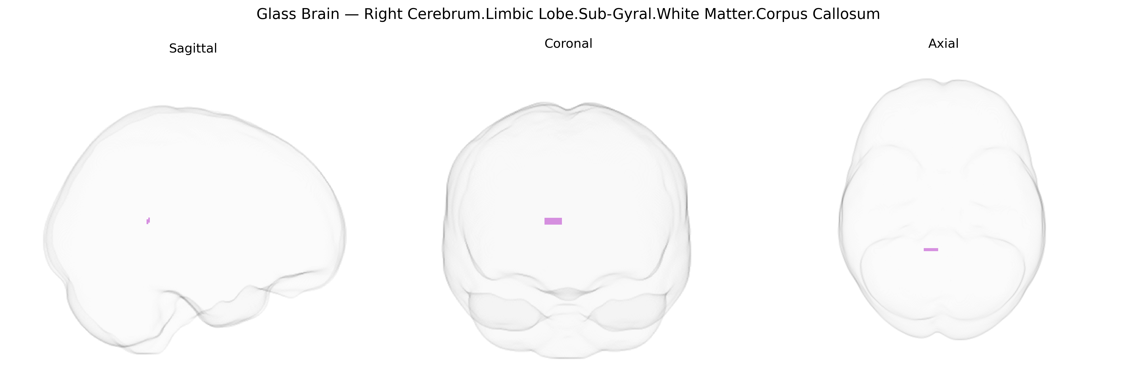 Triplanar Ghost Brain