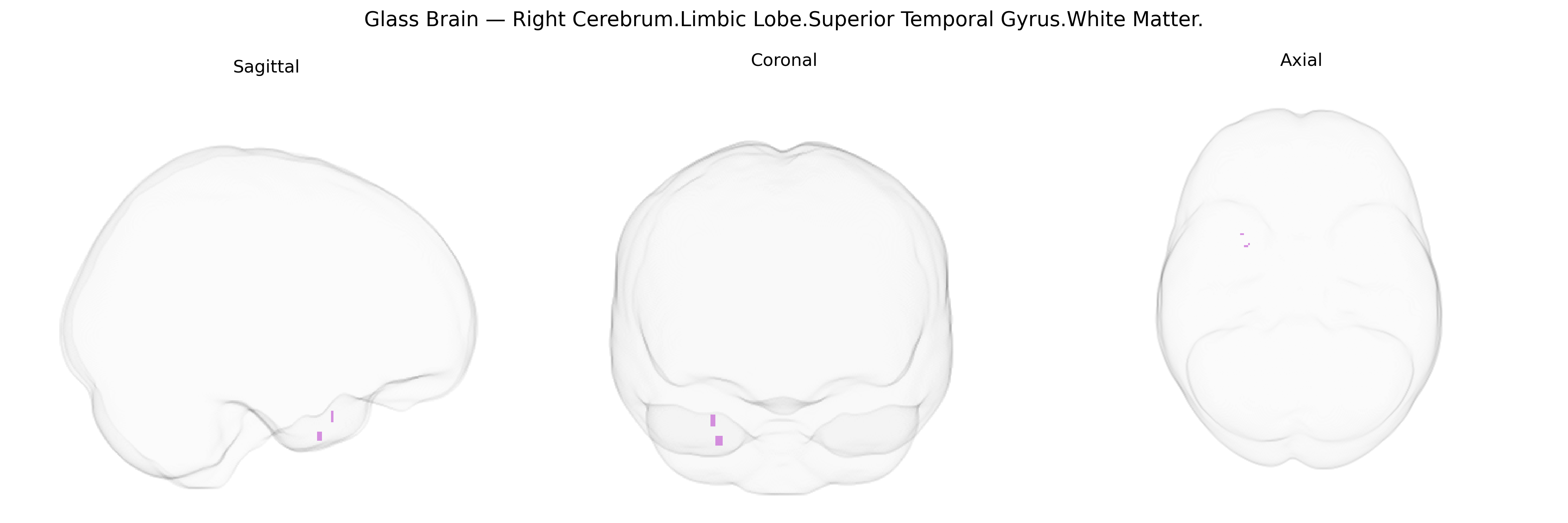 Triplanar Ghost Brain