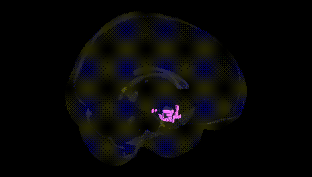 Full Brain Black