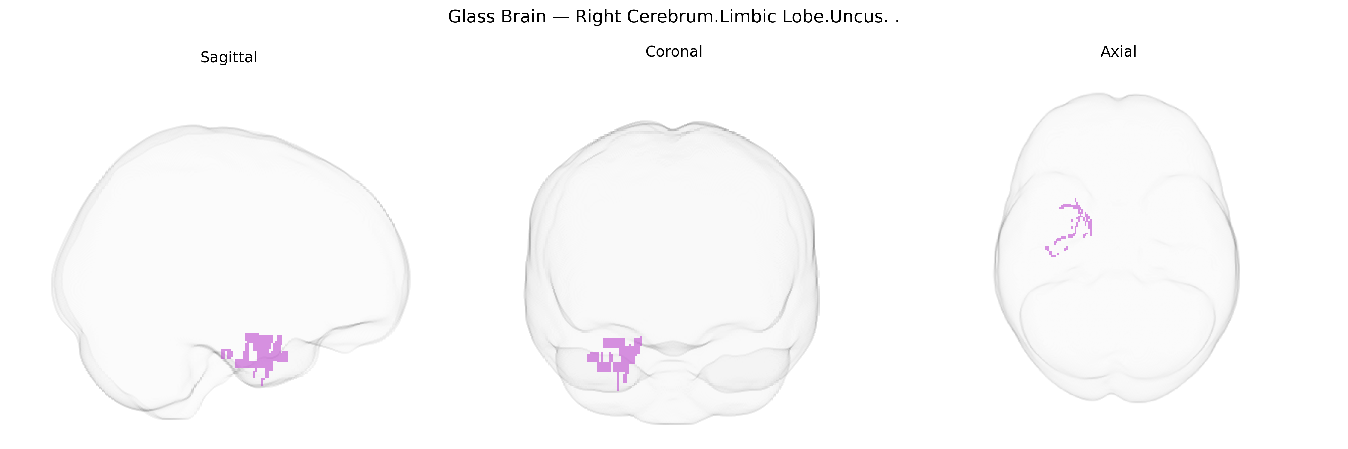 Triplanar Ghost Brain