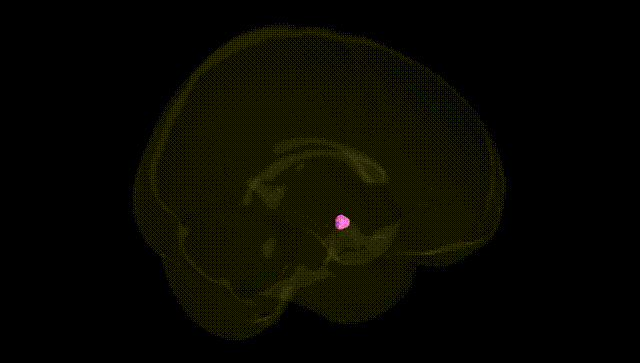 Full Brain Black