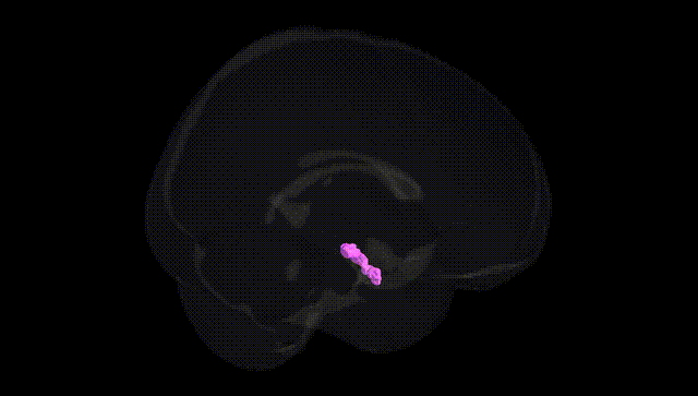 Full Brain Black
